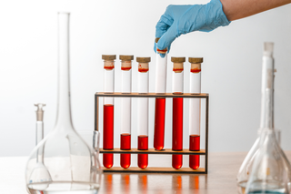 Test Tube Racks Australia for Safe Lab Storage and Sample Handling