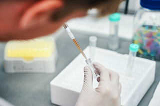 Pipettes for Australian Laboratories: Accurate Liquid Handling for Science, Education and Healthcare