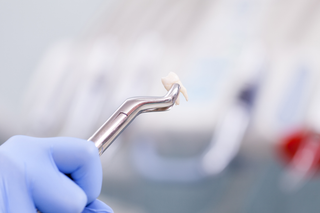 Dental Extraction Tools for Safe and Efficient Tooth Extraction Workflows