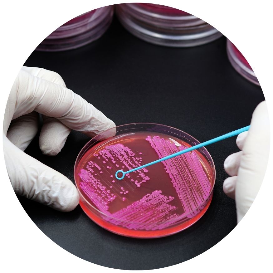 Inoculation Loops – Medilab Marketplace