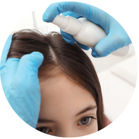 Lice Treatment